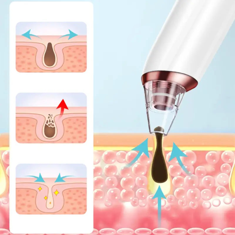 Strumento di bellezza per il viso detergente Multifunzionale - Strumento di bellezza per il viso